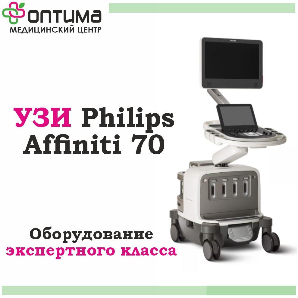 Аппарат УЗИ Phitips Affinity 70